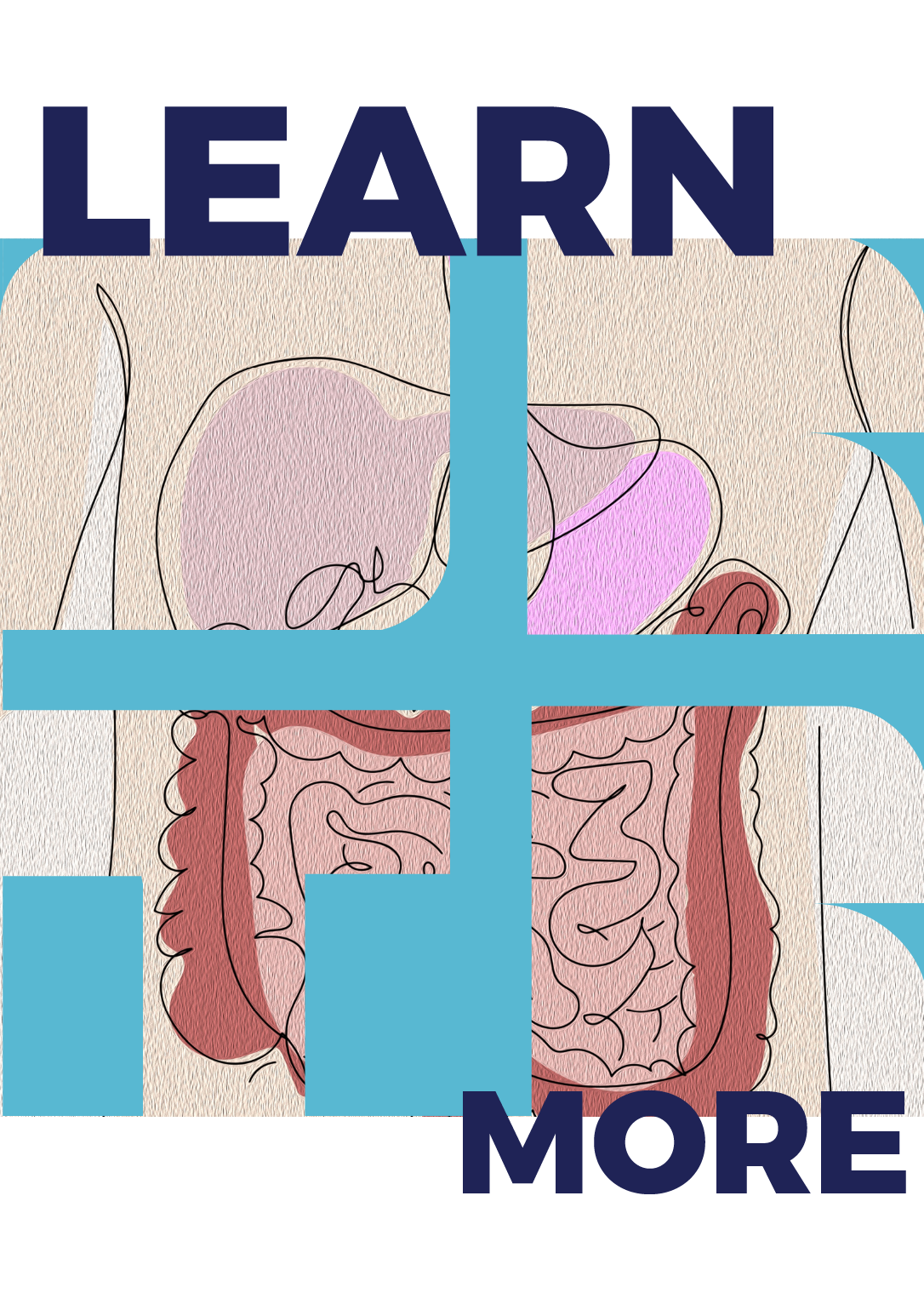 Liver Waiting List Outcomes Calculator 