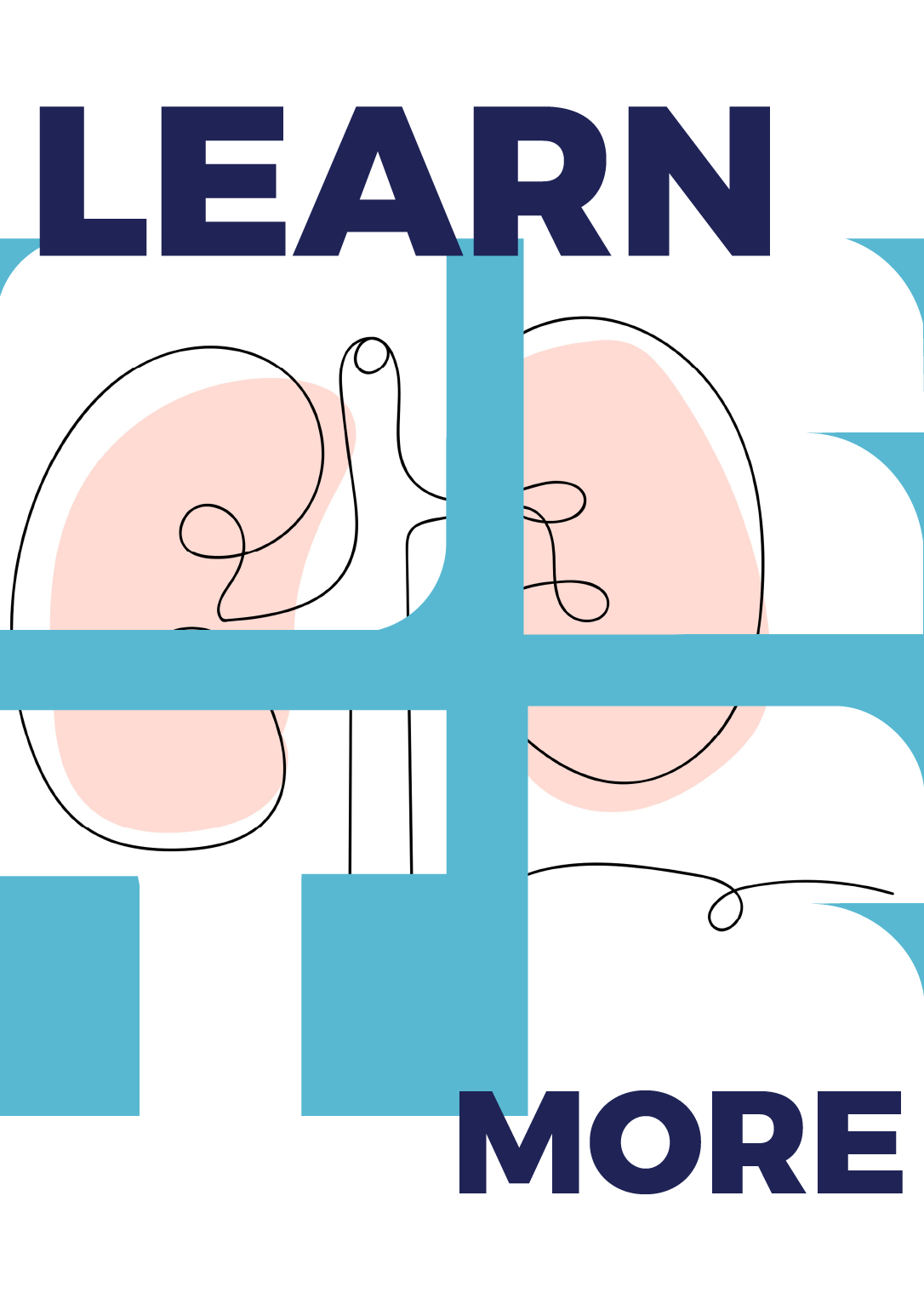 Kidney Transplantation Infographic
