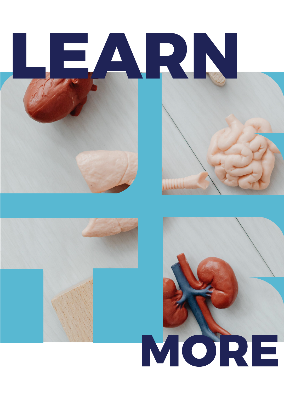 Kidney Transplant Decision Aid 